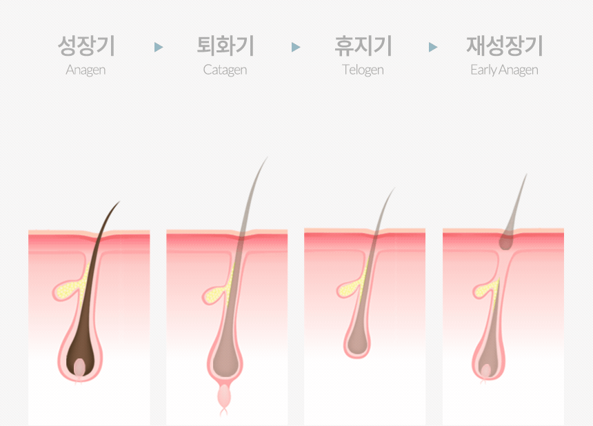 240628-A1_hair_loss_common_04.gif