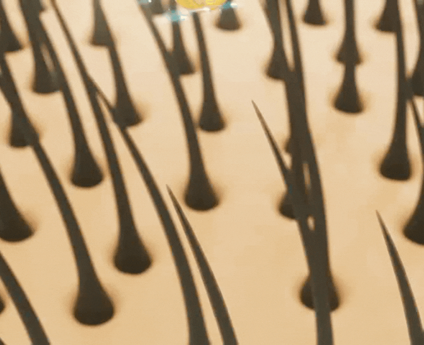 240628-A3_hair_loss_common_01.gif